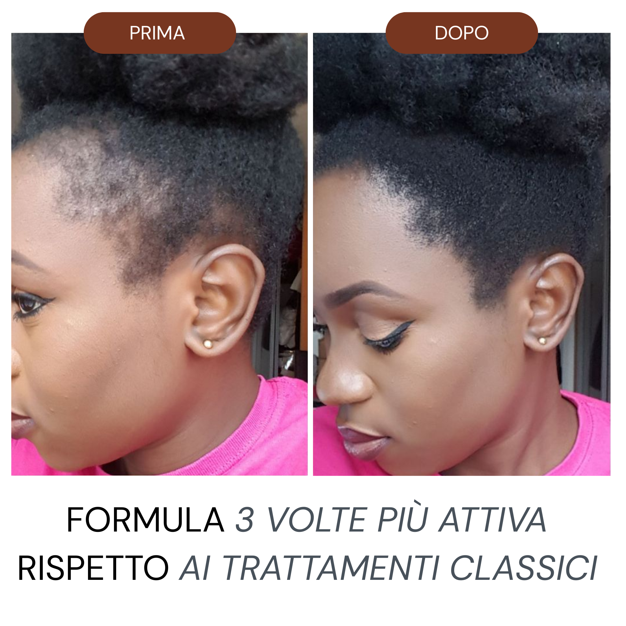 Micro Infusione Rivitalizzante Capelli Afro + Siero extra offerto