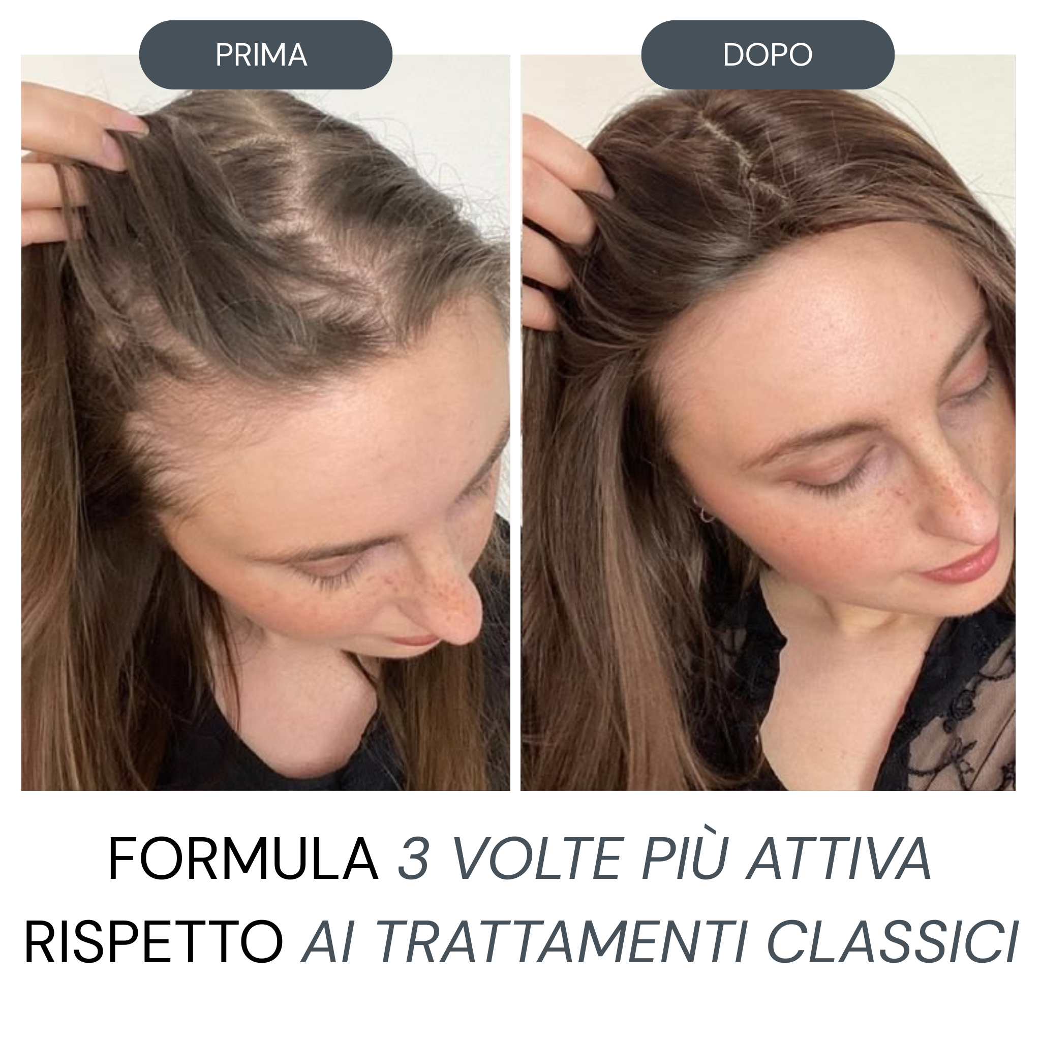 Micro Infusione Rivitalizzante Capelli + Siero extra offerto