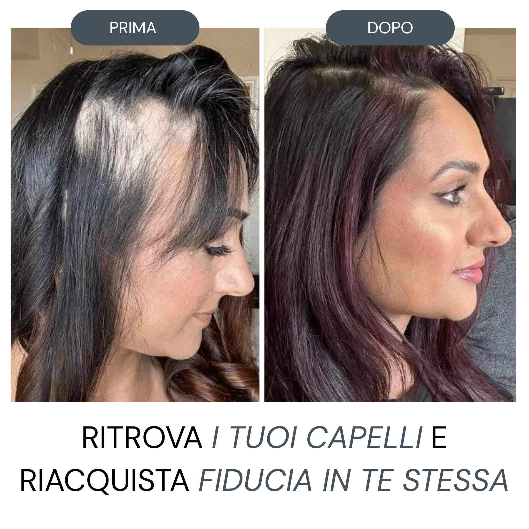 Micro Infusione Rivitalizzante Capelli + Siero extra offerto