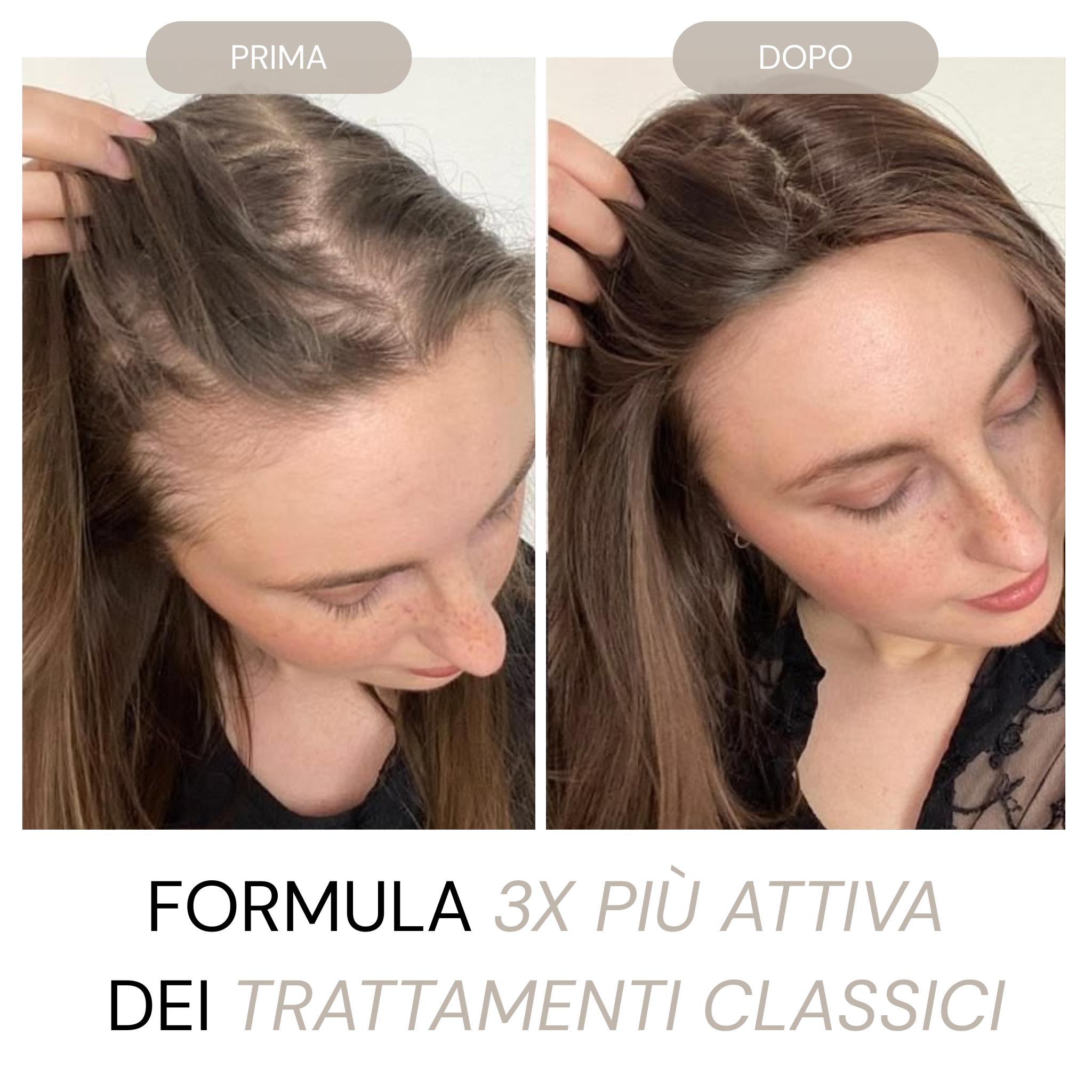 Micro Infusione Rivitalizzante Capelli + Siero extra offerto
