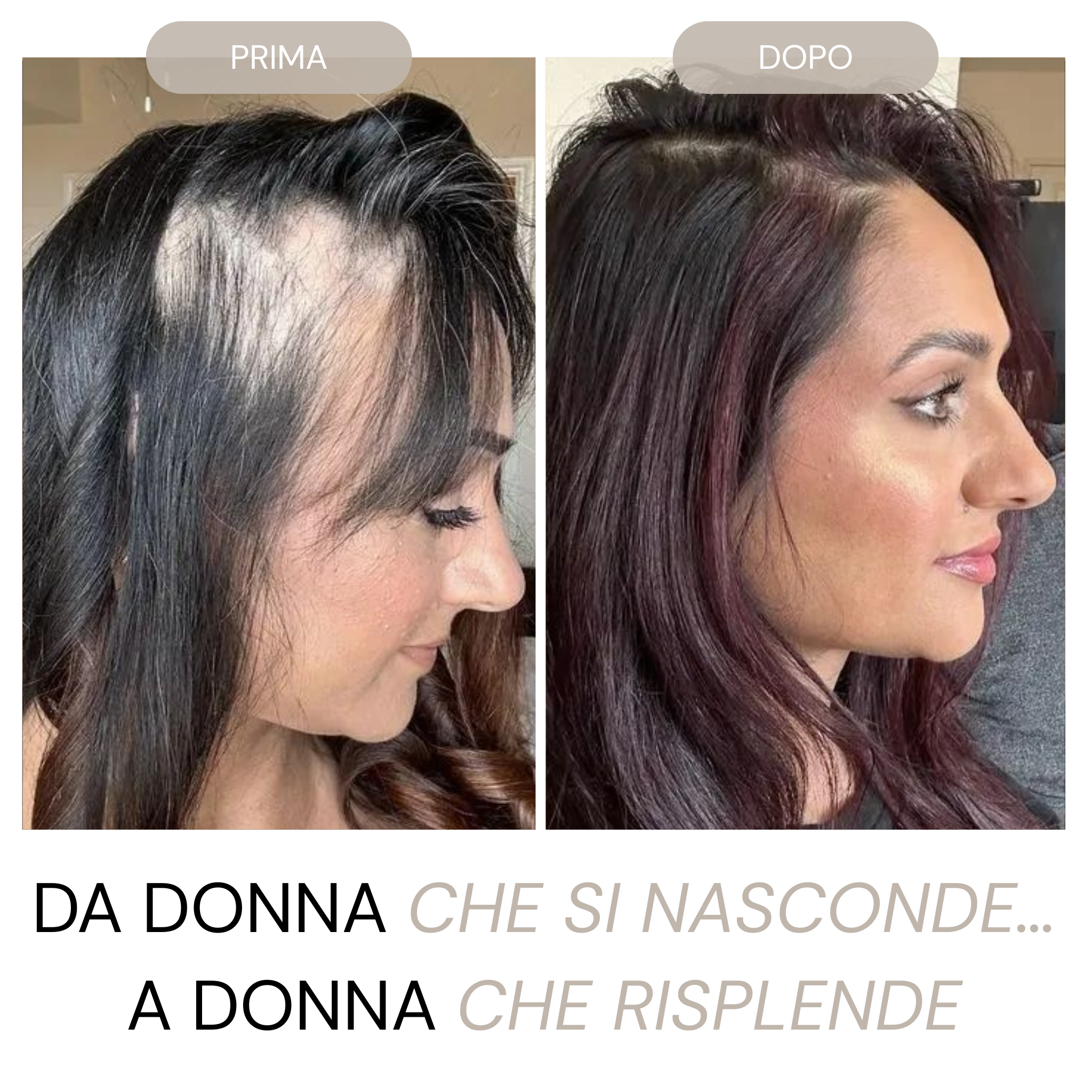 Micro Infusione Rivitalizzante Capelli + Siero extra offerto