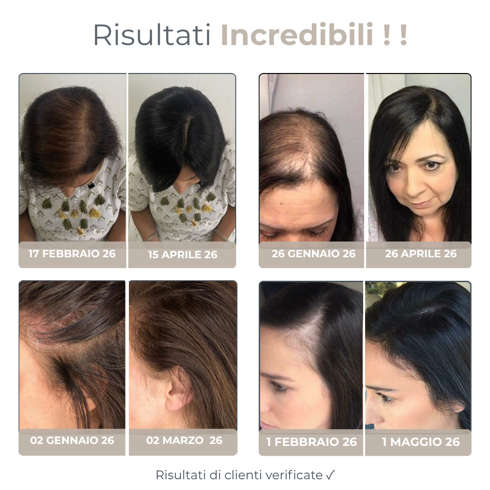 Micro Infusione Rivitalizzante Capelli + Siero extra offerto